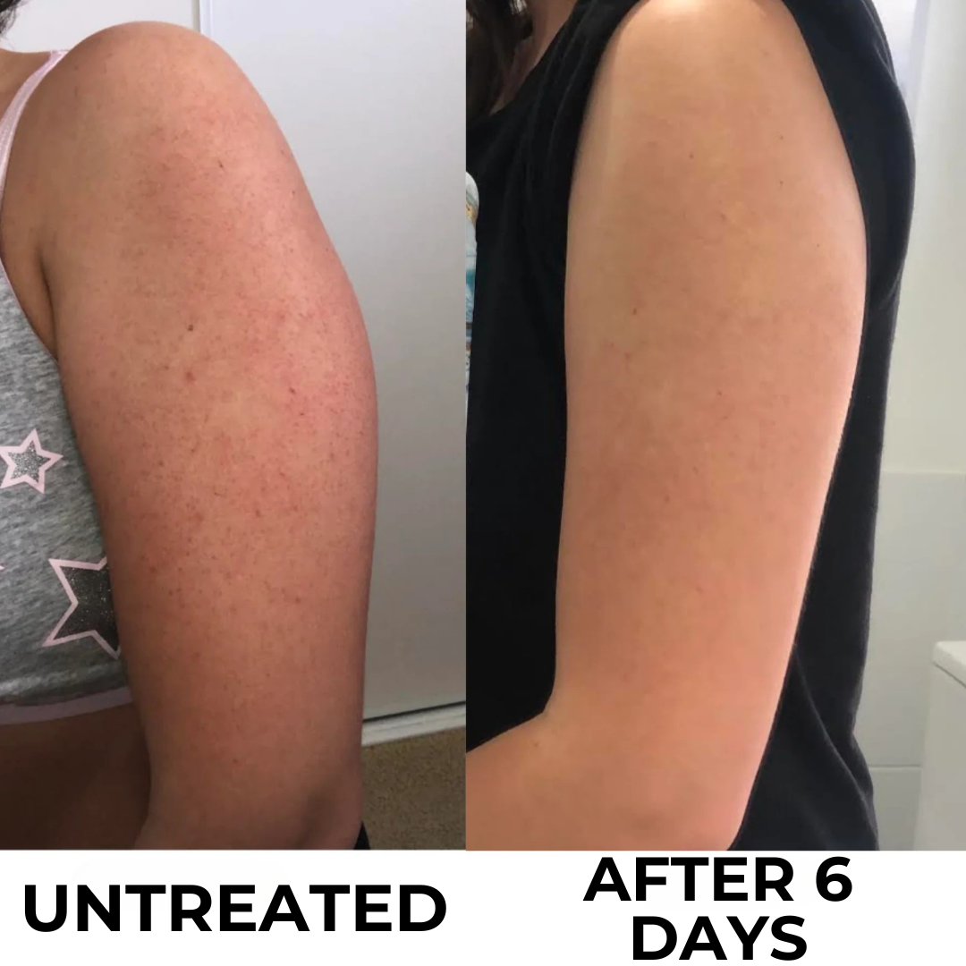 ciencia-before-after
