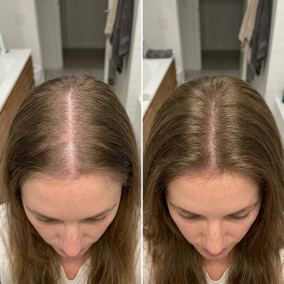 Ashley, 31 años