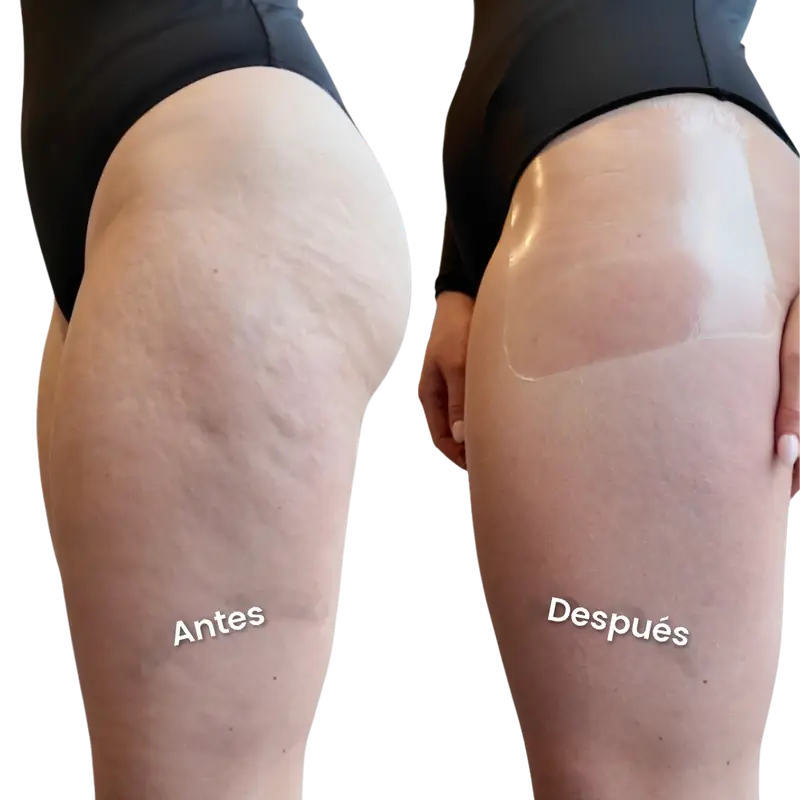 Antes y después en las piernas